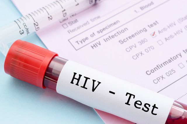 тестування на ВІЛ-інфекцію