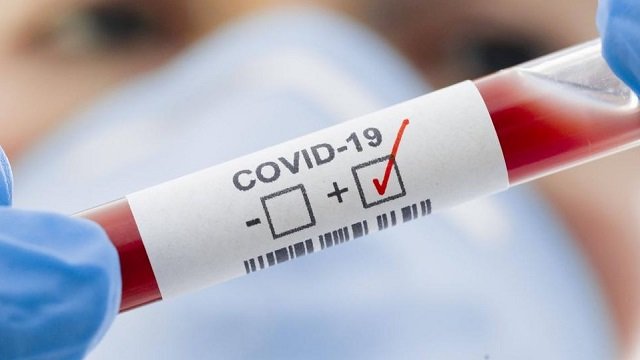 9 черкащан померли минулого тижня через коронавірусну інфекцію