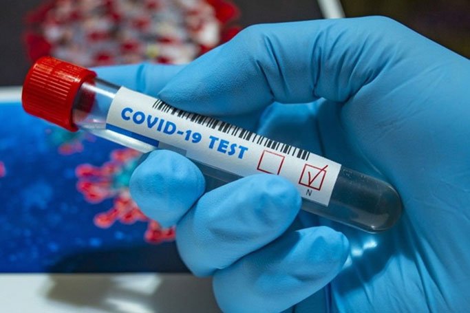 За тиждень в області виявили понад 300 нових випадків COVID-19