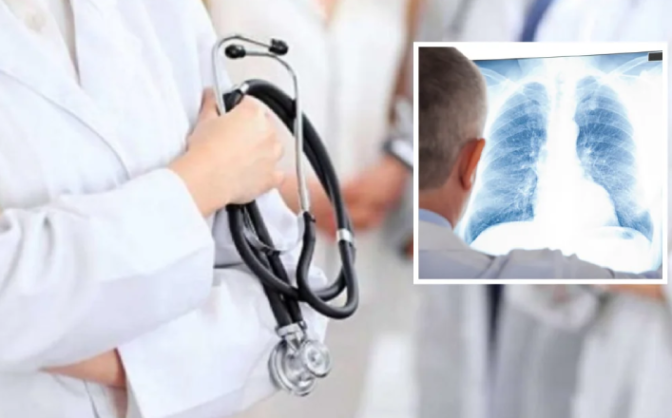 Черкаська область посідає девʼяте місце за рівнем захворюваності на туберкульоз в Україні
